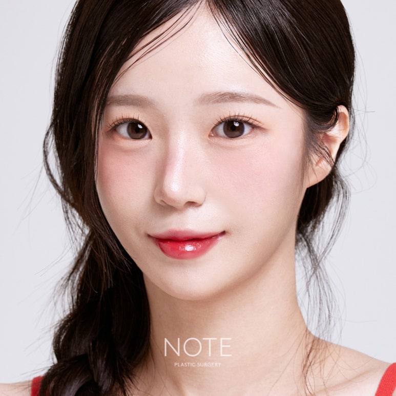 Recommended Place for Nose Plastic Surgery and Contouring Surgery in Nonhyeon: Swelling and Pain After Combined Surgery Explained by NOTE Plastic Surgery in Gangnam image 8