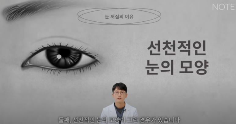 꺼진 눈이 생기는 이유는 따로 있다? 강남 눈성형 잘하는 곳 추천 노트성형외과의 눈꺼짐 해결을 위한 쌍커풀성형과 눈매교정, 지방이식수술 관련 이미지 20