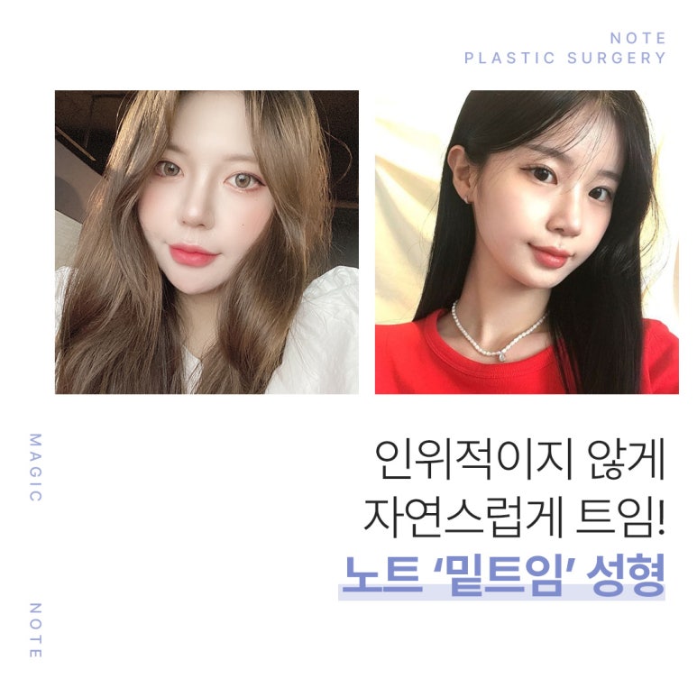 If You're Still Debating Where to Get Epicanthoplasty or Lateral Canthoplasty, Brighten Your Eyes with Note Plastic Surgery’s Precise Canthoplasty at a Trusted Gangnam Eye Surgery Clinic! image 7