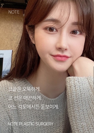 코성형 후기 좋은 곳을 찾고 있다면? 논현역 코성형 잘하는 곳 추천 노트성형외과 관련 이미지 7
