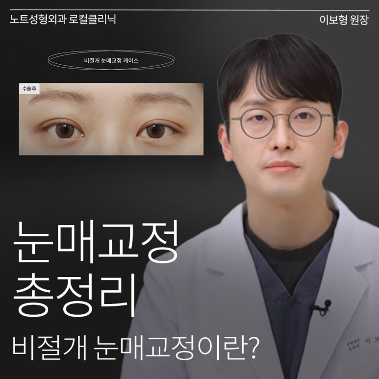 Recommended Famous Place for Double Eyelid Surgery and Eye Plastic Surgery in Nonhyeon: What Is Non-Incisional Ptosis Correction at Note Plastic Surgery in Gangnam? image 1