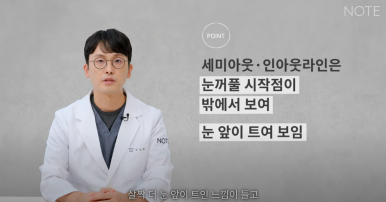 논현역 눈성형 잘하는 곳 노트성형외과의 인라인, 인아웃라인, 아웃라인 쌍꺼풀라인별 쌍꺼풀수술 후 느낌 미리보기 관련 이미지 19
