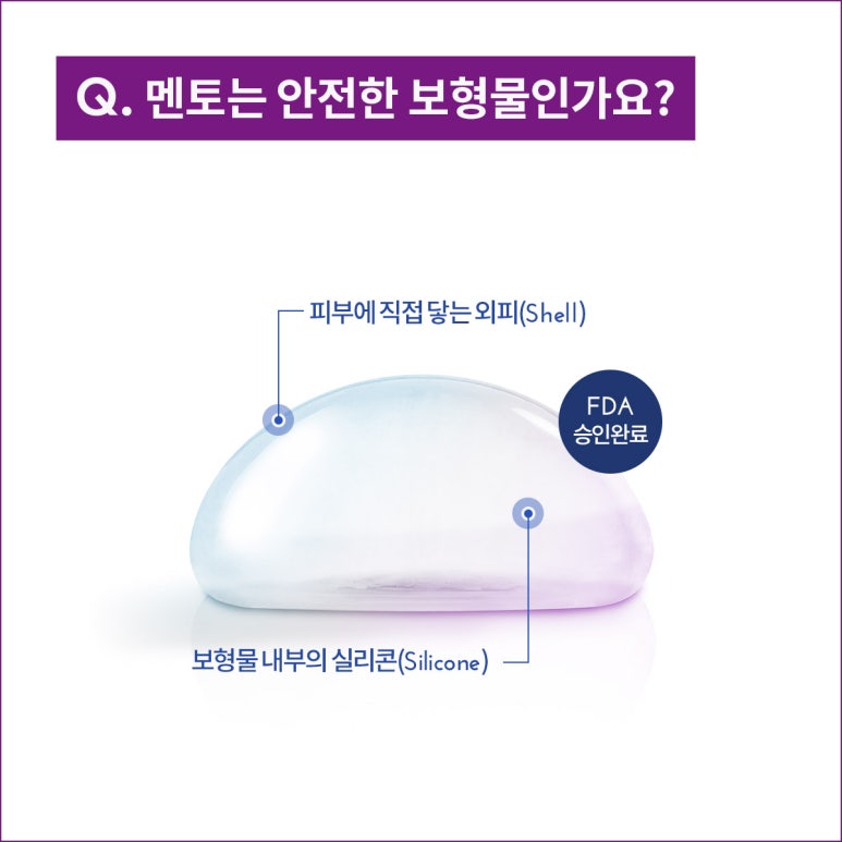 멘토 가슴성형은 노트성형외과 관련 이미지 3