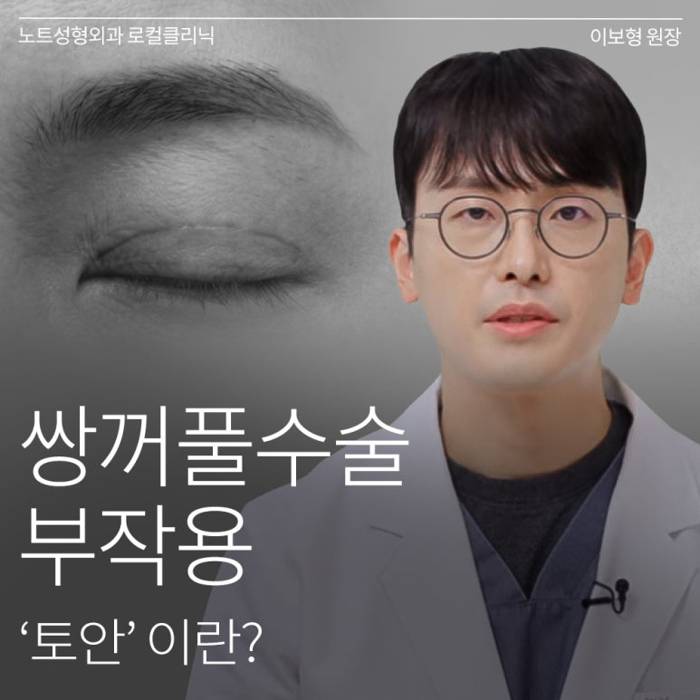 강남 눈재수술 성형외과 눈성형 잘하는 곳 논현 노트성형외과가 말하는 쌍꺼풀 부작용 토안이란? 관련 이미지 1