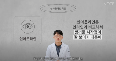 논현역 눈성형 잘하는 곳 노트성형외과의 인라인, 인아웃라인, 아웃라인 쌍꺼풀라인별 쌍꺼풀수술 후 느낌 미리보기 관련 이미지 11