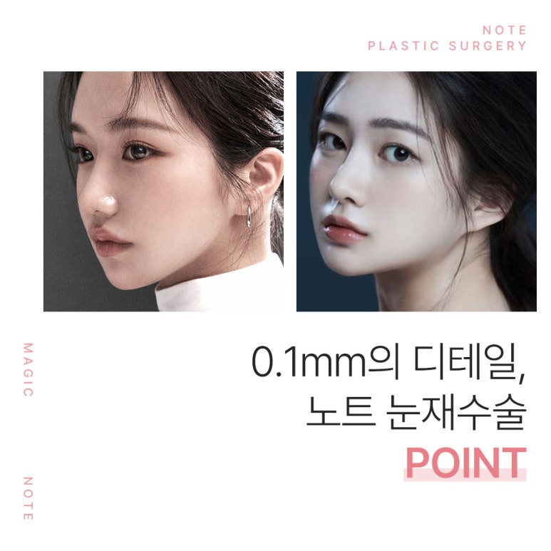 소세지 눈재수술, 눈재수술 붓기 걱정 없는 논현역 눈재수술 성형외과 노트의 당신에게만 집중하는 눈재수술 관련 이미지 6