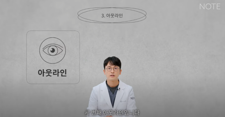 논현역 눈성형 잘하는 곳 노트성형외과의 인라인, 인아웃라인, 아웃라인 쌍꺼풀라인별 쌍꺼풀수술 후 느낌 미리보기 관련 이미지 22
