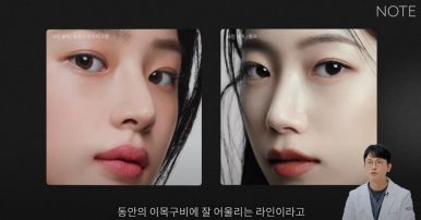 논현역 눈성형 잘하는 곳 노트성형외과의 인라인, 인아웃라인, 아웃라인 쌍꺼풀라인별 쌍꺼풀수술 후 느낌 미리보기 관련 이미지 6