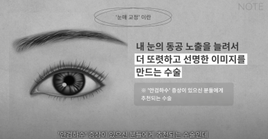 How to Fix Sleepy Eyes with Ptosis Correction and Eye Opening Surgery at Note Plastic Surgery near Nonhyeon Station, a Good Place for Double Eyelid Eye Surgery in Gangnam image 9