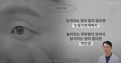 논현 눈수술 성형외과 유명한 곳 눈밑지방재배치 추천 강남 노트성형외과의 눈밑지하안검을 구분하는 자가진단법? 관련 이미지 8