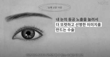 How to Fix Sleepy Eyes with Ptosis Correction and Eye Opening Surgery at Note Plastic Surgery near Nonhyeon Station, a Good Place for Double Eyelid Eye Surgery in Gangnam image 8