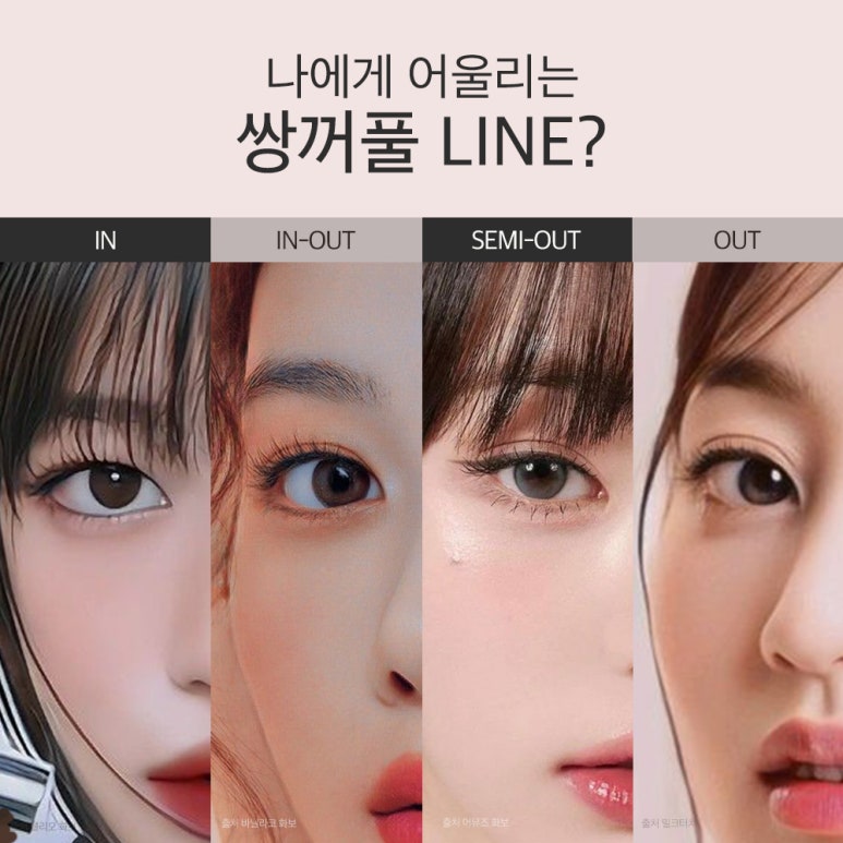 강남 눈성형외과 유명한 곳 추천 노트성형외과의 쌍꺼풀수술 전후는? 올인원 눈성형으로 매몰쌍수와 트임수술을 한번에! 관련 이미지 8