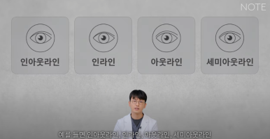 강남 남자눈성형외과 눈수술 잘하는 곳 추천 노트성형외과의 남자속쌍커풀수술 무쌍눈매교정 여자눈성형과의 차이점 관련 이미지 5