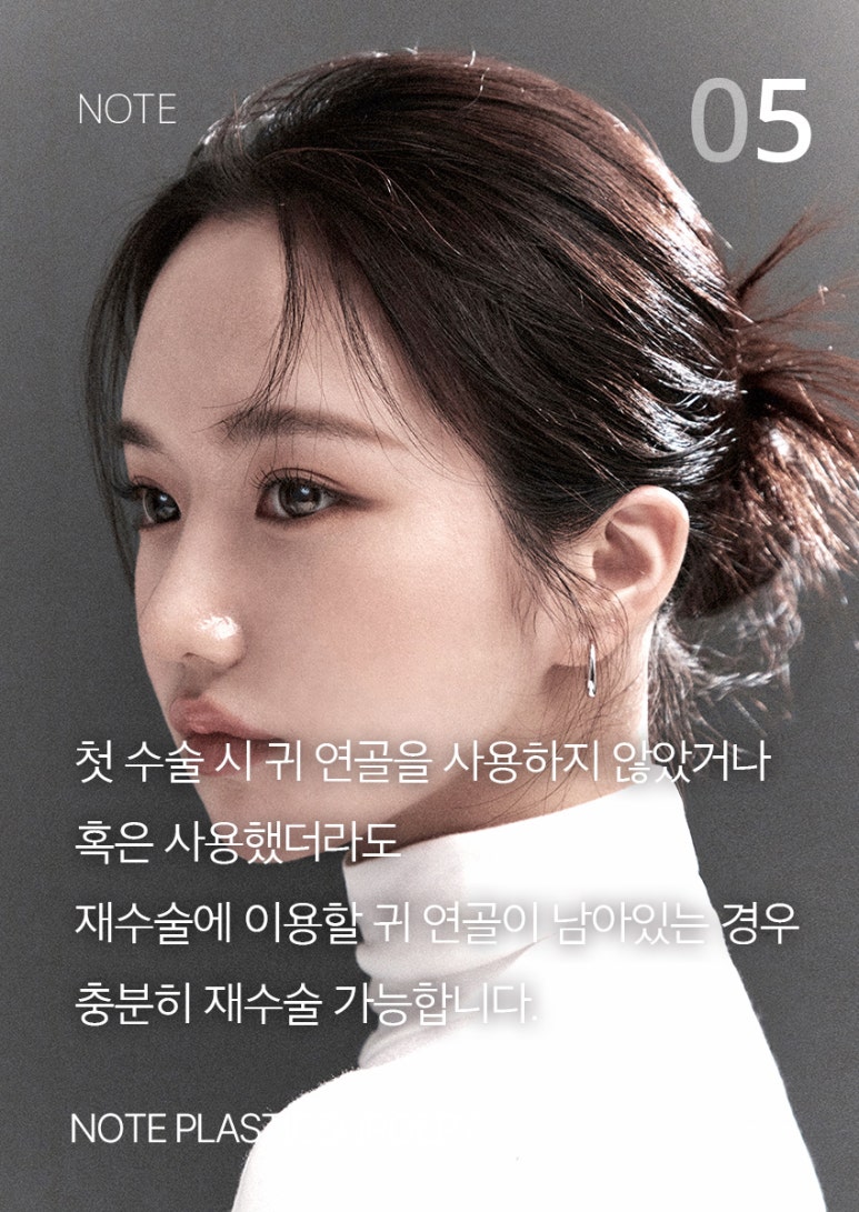 Nose Surgery Without Artificial Implants! A Recommended Nose Surgery Clinic in Nonhyeon, Note Plastic Surgery Clinic for Creating a Natural and Beautiful Nose Without Implants image 6