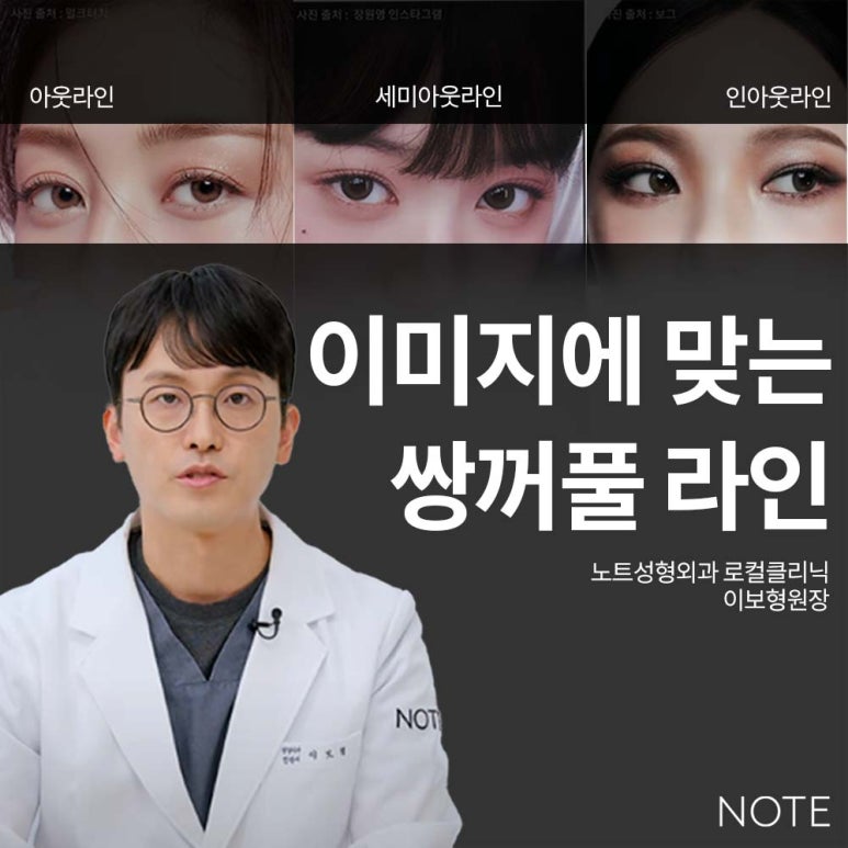 논현역 눈성형 잘하는 곳 노트성형외과의 인라인, 인아웃라인, 아웃라인 쌍꺼풀라인별 쌍꺼풀수술 후 느낌 미리보기 관련 이미지 1