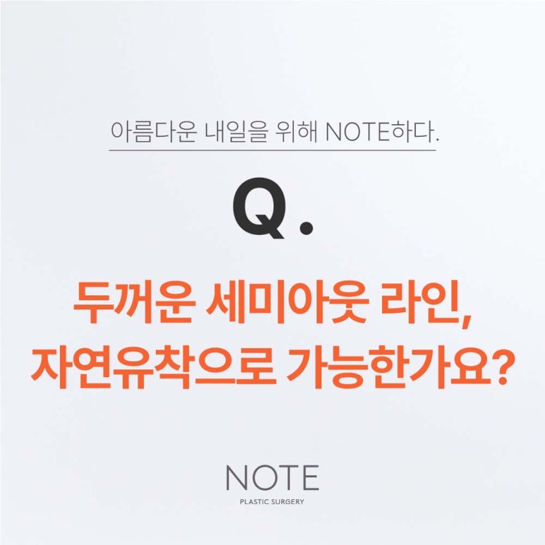 두꺼운 세미아웃라인, 자연유착으로 가능한가요? 논현역 눈성형외과 유명한 곳 노트성형외과가 알려주는 자연유착 쌍꺼풀라인 관련 이미지 2