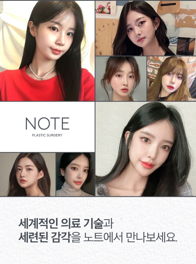 강남 눈성형 쌍꺼풀 재수술 잘하는곳 논현 노트성형외과의 짝눈재수술로 자연스러운 눈성형 관련 이미지 11