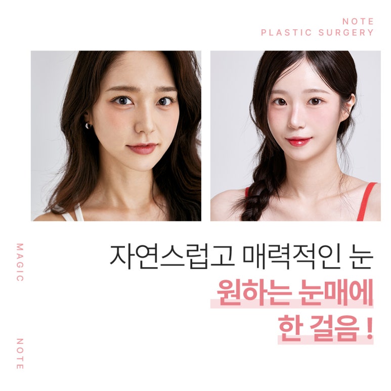 A Review of Revision Eyelid Surgery That Speaks for Itself: A Famous Eyelid Surgery Clinic Near Nonhyeon Station, Note Plastic Surgery’s Final Revision Eyelid Surgery Recommendations and Case Explanations image 9