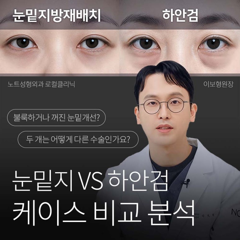 논현 눈성형외과 추천 하안검수술 눈밑지방재배치 잘하는 곳 강남 노트성형외과의 중년 눈성형 케이스 비교 분석 관련 이미지 1