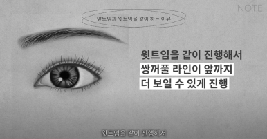 Double Eyelid Surgery: Is There a Procedure That Makes the Eyes Even Prettier When Done Together? A Great Place for Eye Plastic Surgery in Gangnam — NOTE Plastic Surgery: Canthoplasty, Ptosis Correction, and Forehead Lift image 18