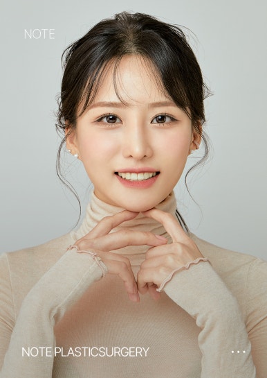 눈재수술 후기가 궁금하다면? 강남 눈재수술 병원 노트성형외과 눈재수술 관련 이미지 2