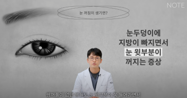 꺼진 눈이 생기는 이유는 따로 있다? 강남 눈성형 잘하는 곳 추천 노트성형외과의 눈꺼짐 해결을 위한 쌍커풀성형과 눈매교정, 지방이식수술 관련 이미지 6