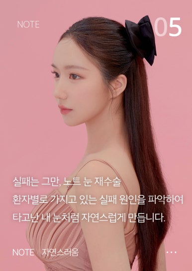 쌍꺼풀 수술보다 쌍수재수술이 더 어렵다? 강남 눈재수술 잘하는 곳 노트성형외과 관련 이미지 7