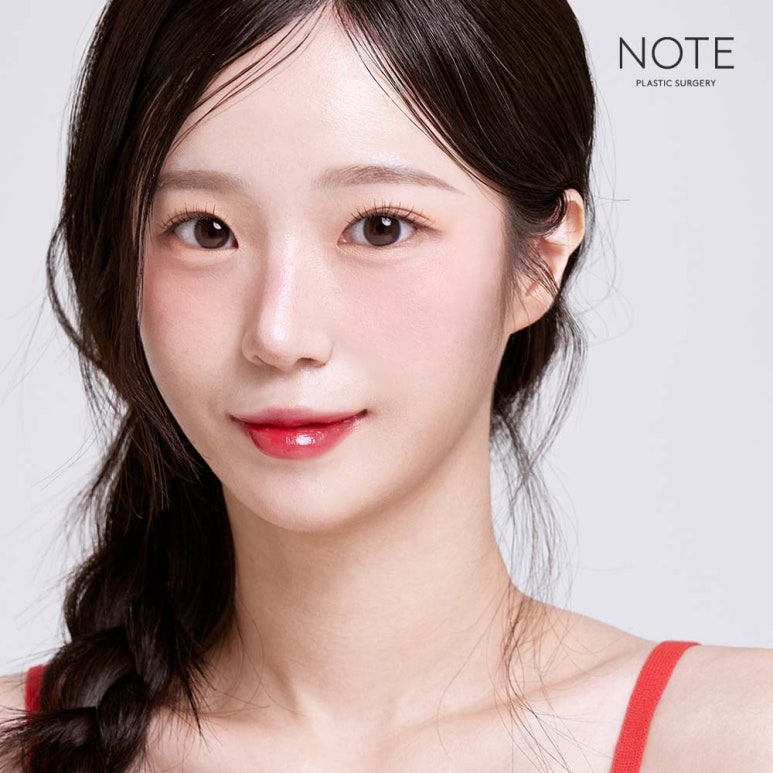논현 코수술 윤곽성형외과 유명한 곳 추천 강남 노트성형외과의 코성형 윤곽수술 복합수술 시 그 순서는? 관련 이미지 8