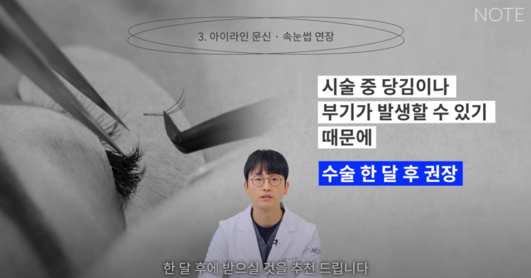 강남 눈성형외과 쌍꺼풀수술 잘하는 곳 논현역 노트성형외과가 알려주는 눈수술 후 주의사항! 관련 이미지 6