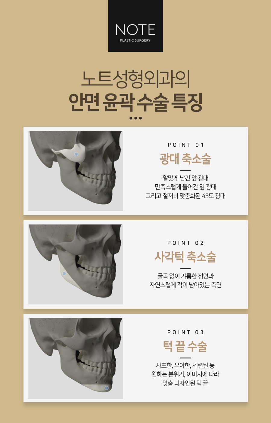 논현 노트성형외과의 안면윤곽술 (with유지한원장) 관련 이미지 4