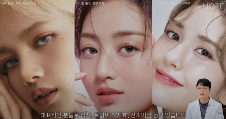 논현역 눈성형 잘하는 곳 노트성형외과의 인라인, 인아웃라인, 아웃라인 쌍꺼풀라인별 쌍꺼풀수술 후 느낌 미리보기 관련 이미지 29