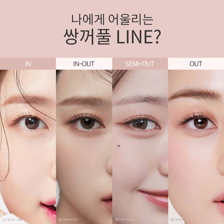 강남쌍꺼풀 트임눈성형외과 유명한곳 추천 논현역 노트성형외과의 올인원 쌍커풀 트임수술로 개인 맞춤형 눈성형을 관련 이미지 5