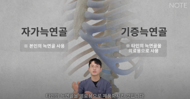 Recommended place for rhinoplasty in Gangnam: Nohyeon Note Plastic Surgery explains the difference between autologous rib cartilage and donated rib cartilage! image 5