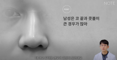 논현 코수술 남자코성형외과 유명한 곳 추천 강남 노트성형외과가 말하는 남자콧볼축소와 남자복코수술 방법은? 관련 이미지 6