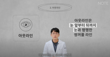 논현역 눈성형 잘하는 곳 노트성형외과의 인라인, 인아웃라인, 아웃라인 쌍꺼풀라인별 쌍꺼풀수술 후 느낌 미리보기 관련 이미지 23