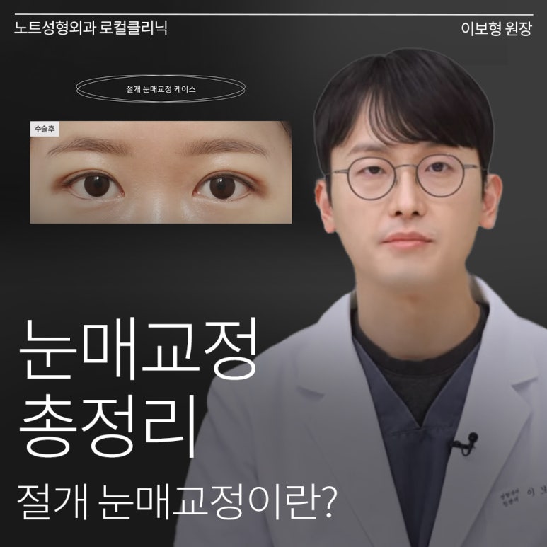 논현 쌍꺼풀수술 눈성형 유명한 곳 추천 강남 노트성형외과의 절개 눈매교정이란? 관련 이미지 1