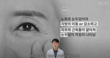 꺼진 눈이 생기는 이유는 따로 있다? 강남 눈성형 잘하는 곳 추천 노트성형외과의 눈꺼짐 해결을 위한 쌍커풀성형과 눈매교정, 지방이식수술 관련 이미지 18