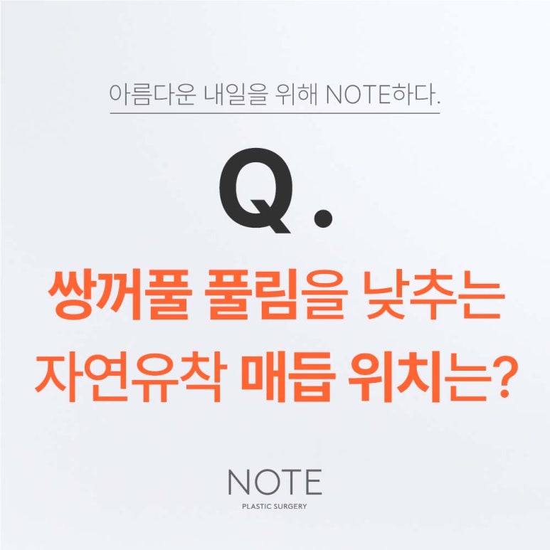 강남 쌍꺼풀 눈수술 잘하는 곳 추천 논현역 노트성형외과가 말하는 풀림 없는 자연유착 쌍커풀 매듭 위치는? 관련 이미지 2