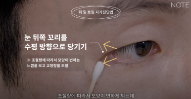 Gangnam Eye Plastic Surgery Clinic: A place that does eye corner surgery well, Nonhyeon Station Note Plastic Surgery explains—Is my eye suitable for corner surgery? Epicanthoplasty, outer canthoplasty, and lower canthoplasty image 15