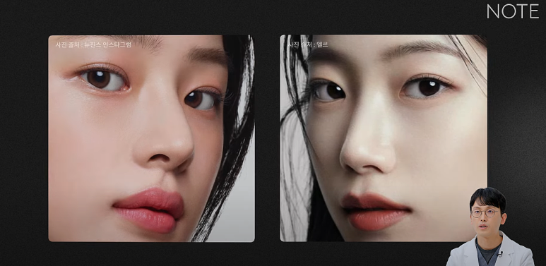 올인원 눈성형으로 매몰과 트임을 동시에! 나에게 맞는 맞춤형 눈성형, 논현역 눈성형 잘하는 곳 노트성형외과 추천 관련 이미지 6