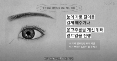 Double Eyelid Surgery: Is There a Procedure That Makes the Eyes Even Prettier When Done Together? A Great Place for Eye Plastic Surgery in Gangnam — NOTE Plastic Surgery: Canthoplasty, Ptosis Correction, and Forehead Lift image 16