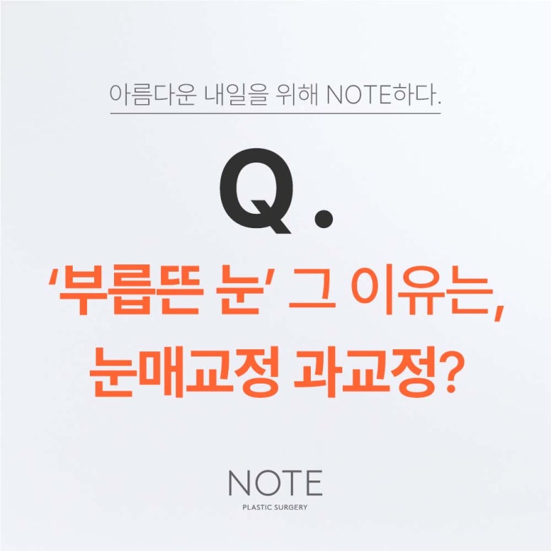 What Are the Side Effects of Overcorrection in Ptosis Correction Surgery, as Explained by Note Plastic Surgery near Nonhyeon Station, a Great Place for Eye Plastic Surgery in Gangnam? Non-incisional Ptosis Correction, Incisional Ptosis Correction image 2