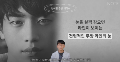 Male Eye Surgery: If You’re Not Sure Which Double Eyelid Suits You, Preview of Note Plastic Surgery’s Male Monolid Double-Eyelid Line Surgery Method at Nonhyeon Station, a Place Known for Male Eye Surgery! image 13