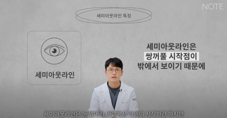 논현역 눈성형 잘하는 곳 노트성형외과의 인라인, 인아웃라인, 아웃라인 쌍꺼풀라인별 쌍꺼풀수술 후 느낌 미리보기 관련 이미지 13