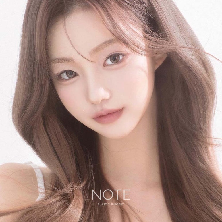 강남 쌍꺼풀재수술 눈재수술 잘하는 곳 논현역 노트성형외과의 눈성형재수술로 쌍커풀라인 낮추기 관련 이미지 7