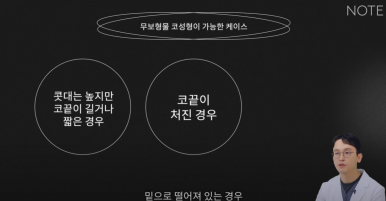 Recommended Nose Surgery Clinic in Nonhyeon: Cases Where Non-Implant Rhinoplasty Is Possible, as Explained by Note Plastic Surgery in Gangnam! image 7