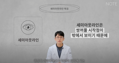 논현역 눈성형 잘하는 곳 노트성형외과의 인라인, 인아웃라인, 아웃라인 쌍꺼풀라인별 쌍꺼풀수술 후 느낌 미리보기 관련 이미지 14