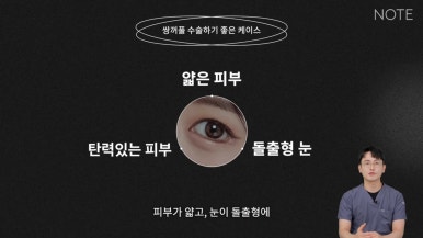 눈성형, 아직 고민 중이라면? 논현역 쌍꺼풀 수술 추천 병원 노트성형외과의 수술 후 예쁜 눈 미리 알기! 관련 이미지 6