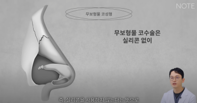 강남 코성형외과 코수술 잘하는 곳 추천 논현역 노트성형외과의 무보형물 자가연골 코성형수술로 자연스러운 코성형 관련 이미지 8