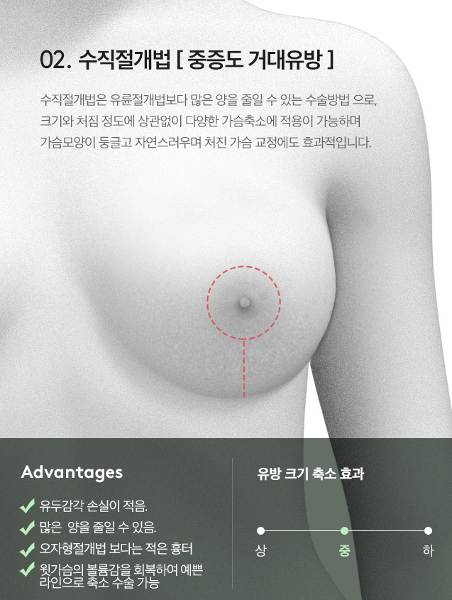 [Note Plastic Surgery] Let’s Learn About Breast Reduction! image 3